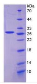 SDS-PAGE (FOLR1-241H).jpg
